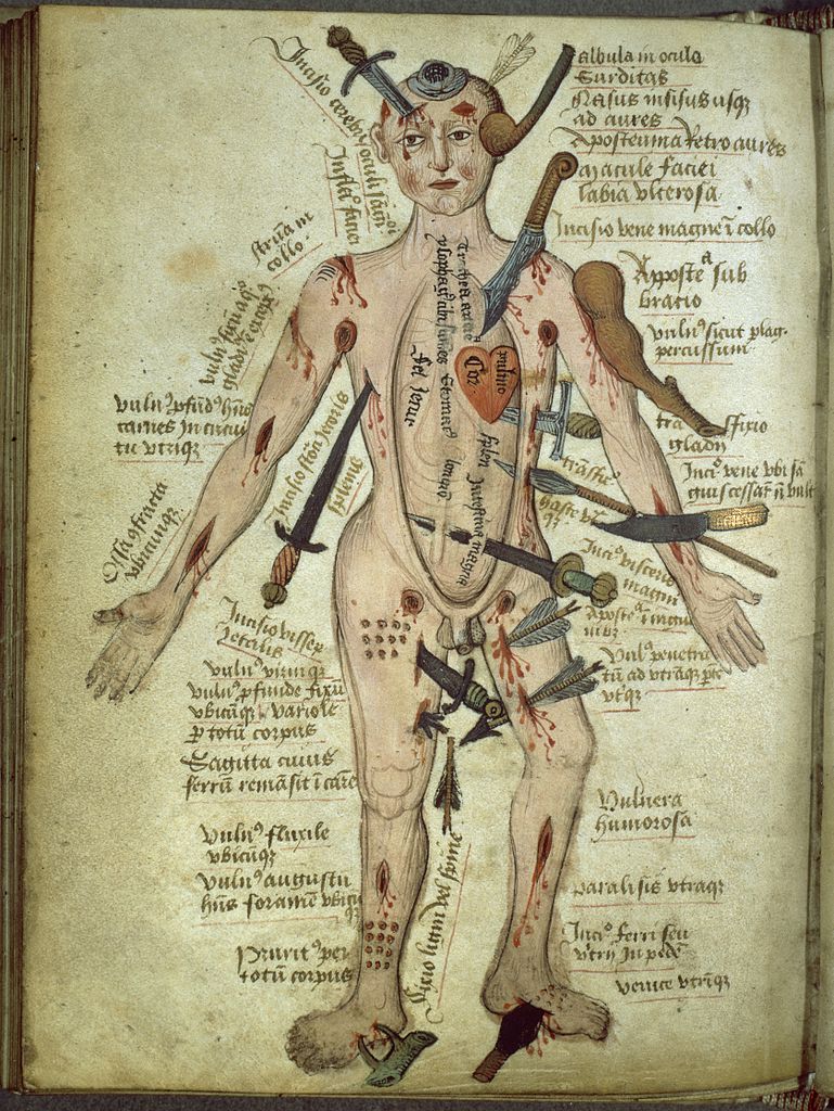 Военная медицина древности и Средних веков 2